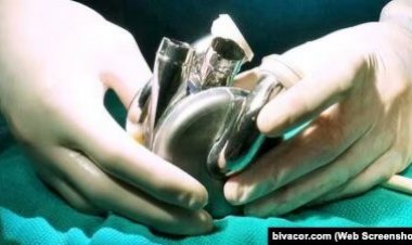 Dünyada bir ilk: Yapay kalple taburcu oldu 100 günden fazla hayatta kaldı