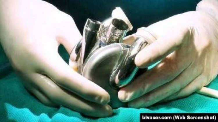 Dünyada bir ilk: Yapay kalple taburcu oldu 100 günden fazla hayatta kaldı